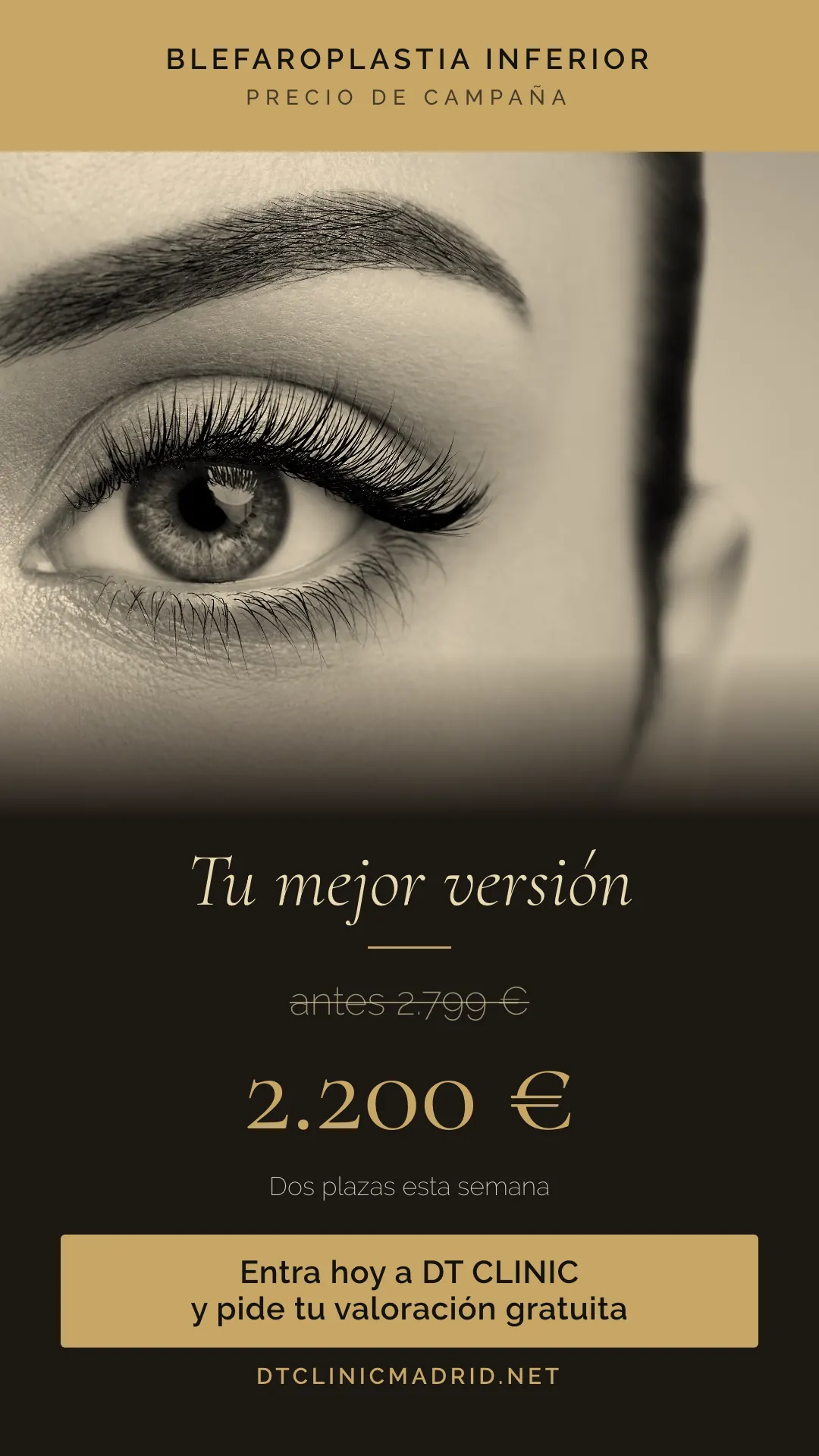Anuncio de blefaroplastia inferior en Madrid: 2.200 euros, antes 2.799 euros, en DT Clinic