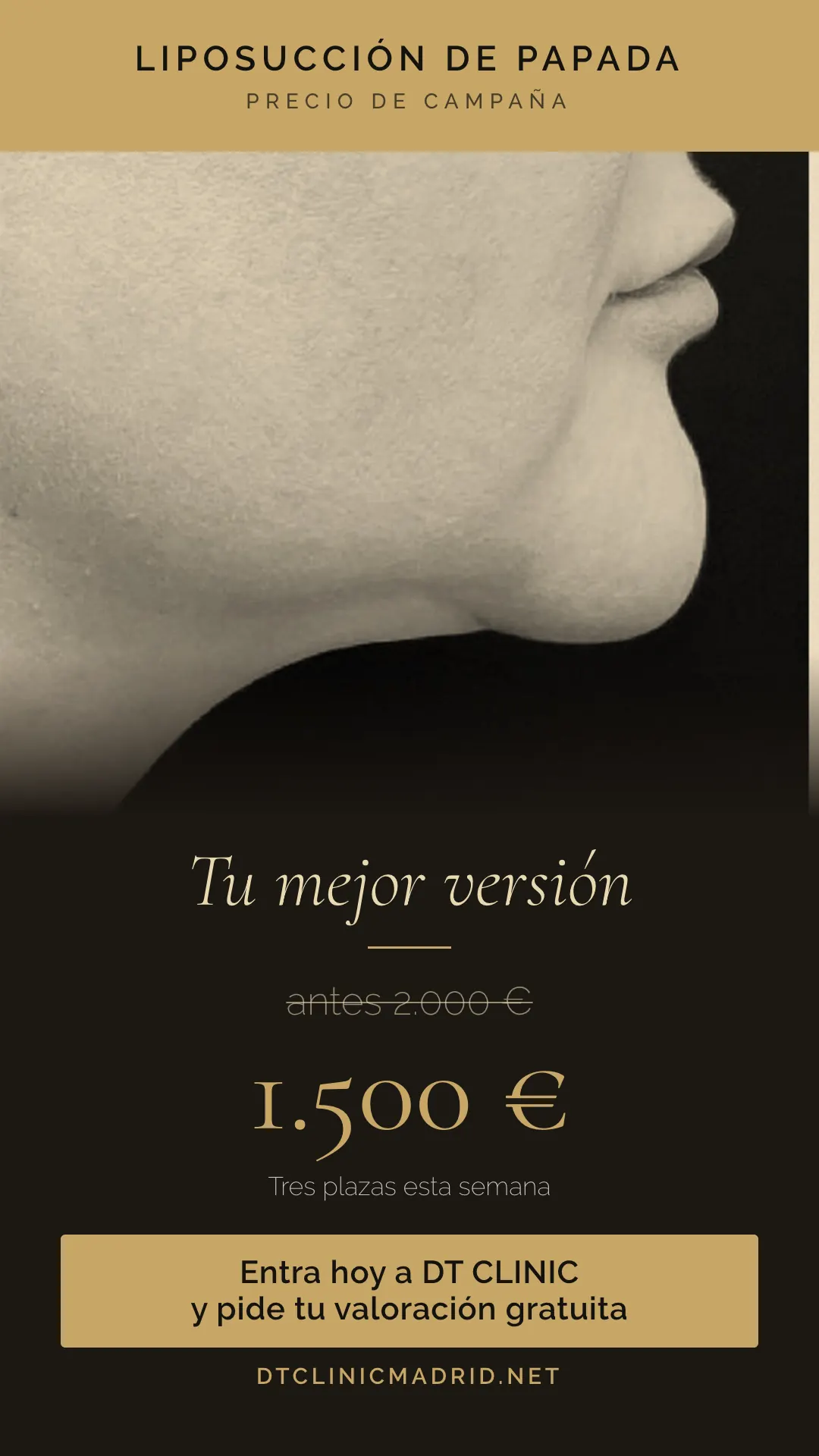 Anuncio de liposucción de papada en Madrid: 1.500 euros, antes 2.000 euros, en DT Clinic